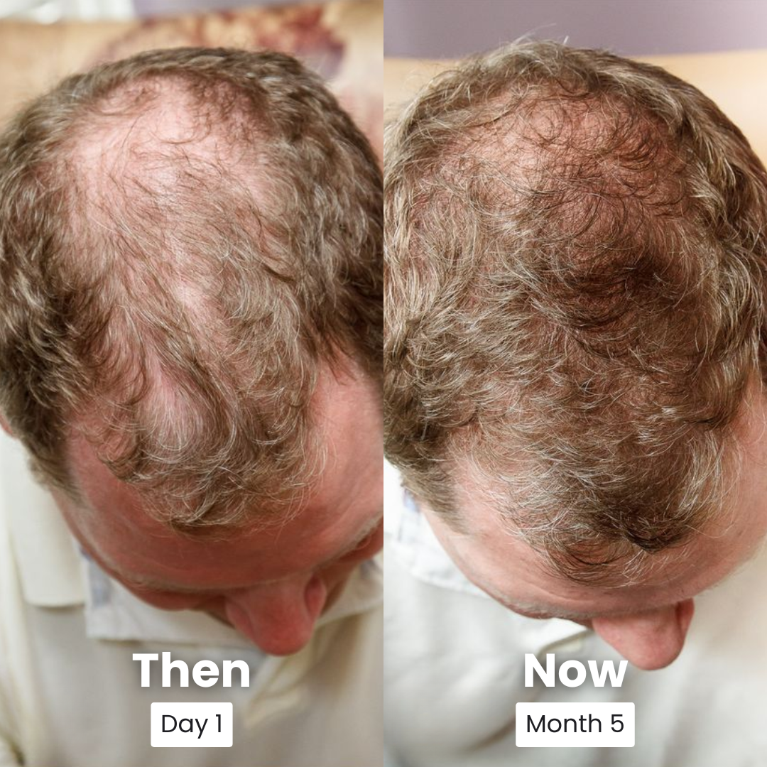 Peptide Hair Serum