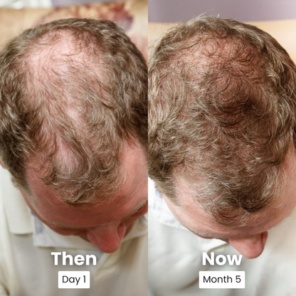 Peptide Hair Serum
