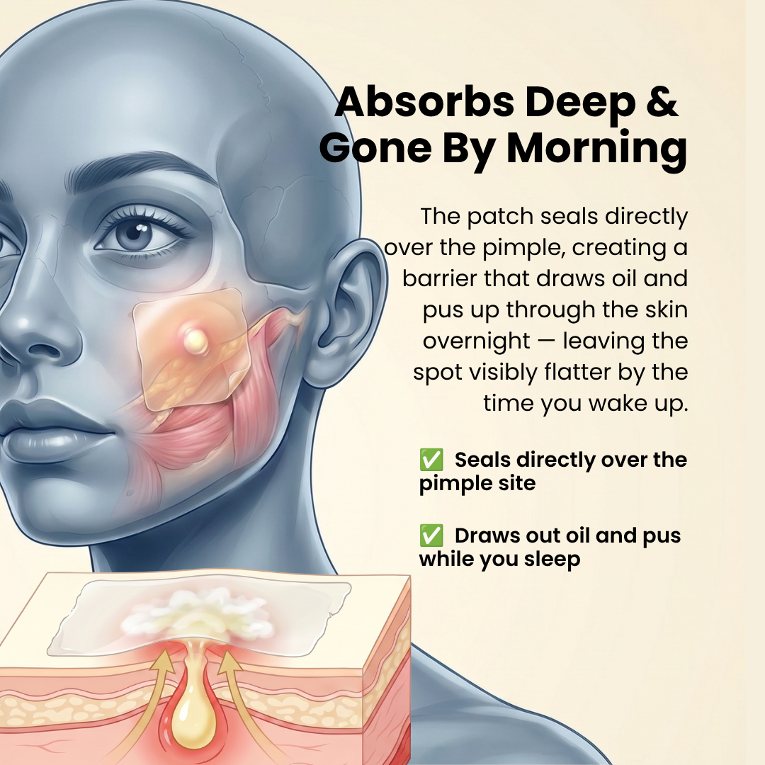 Overnight Pimple Patch