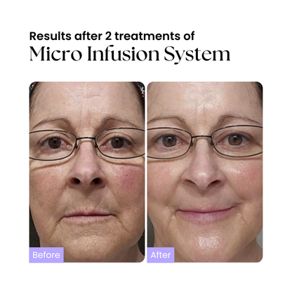 Glow Micro-Infusion System