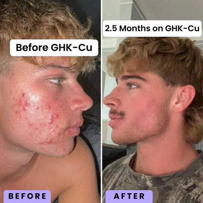 Advanced Copper Peptide Tightening Serum