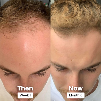 Peptide Hair Serum